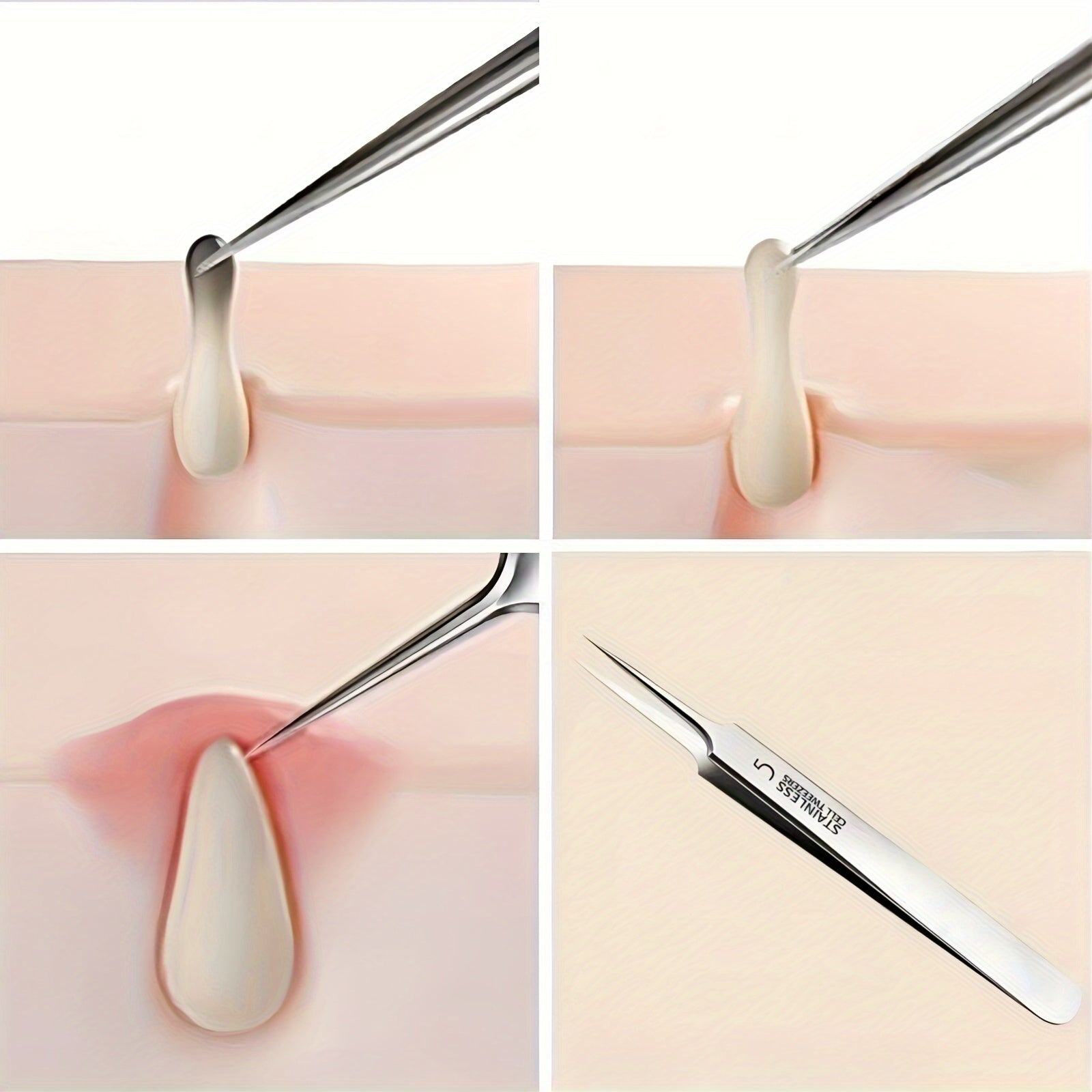 2pcs professional precision ultra fine tip blackhead
