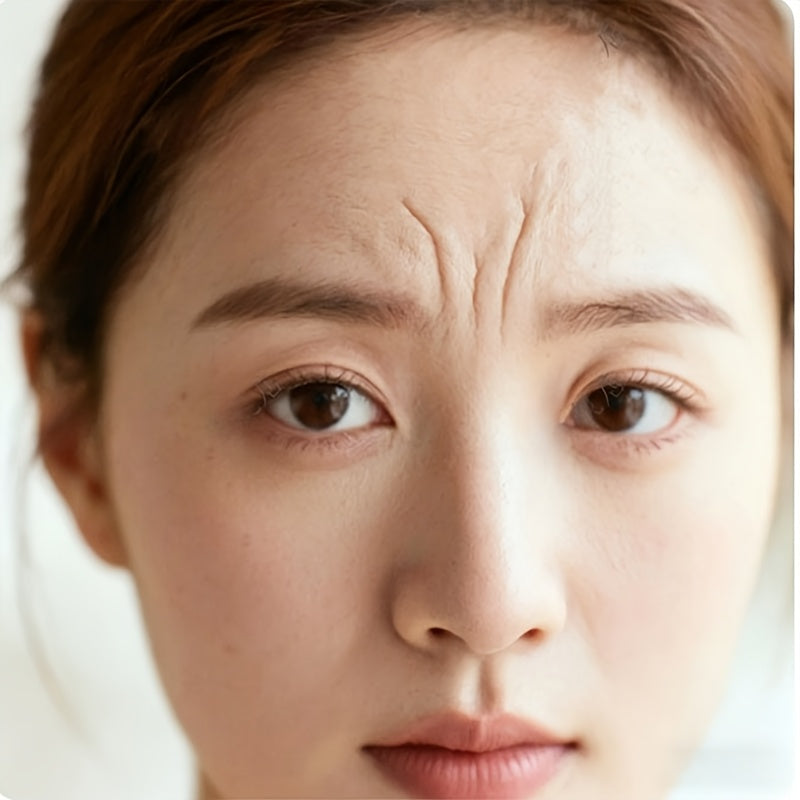 48pcs self   sleep forehead patches reusable elastic